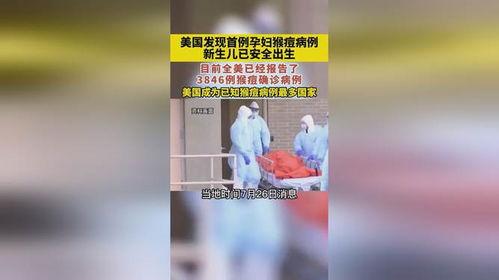 美国猴痘爆料新闻报道视频,最新爆料新闻报道视频揭秘